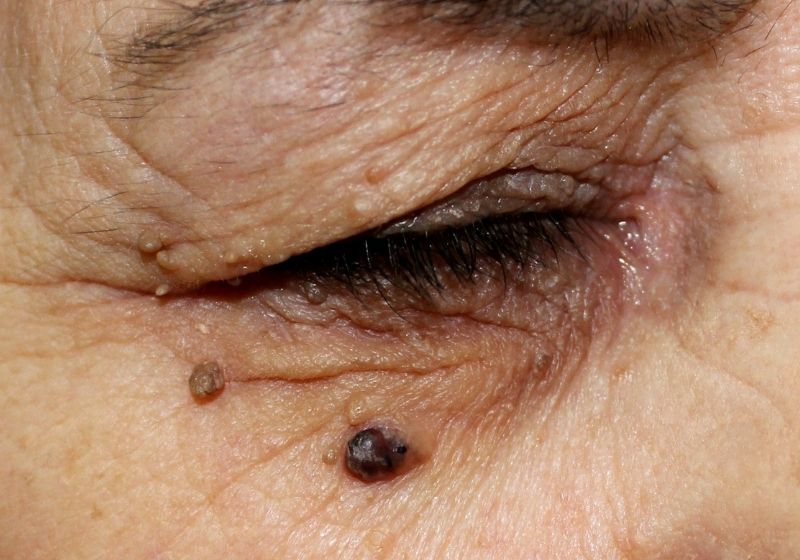 Apresentação clínica: